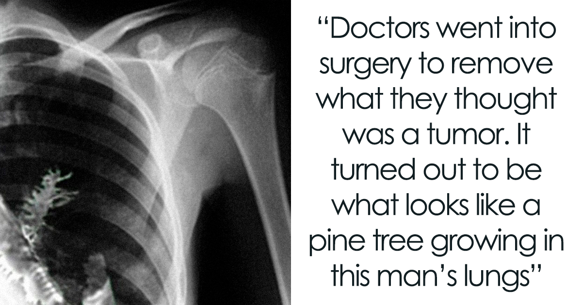 Guy Shares Disturbing Facts To “Ruin Your Day” And Here’s 35 Of The Most Upsetting Ones