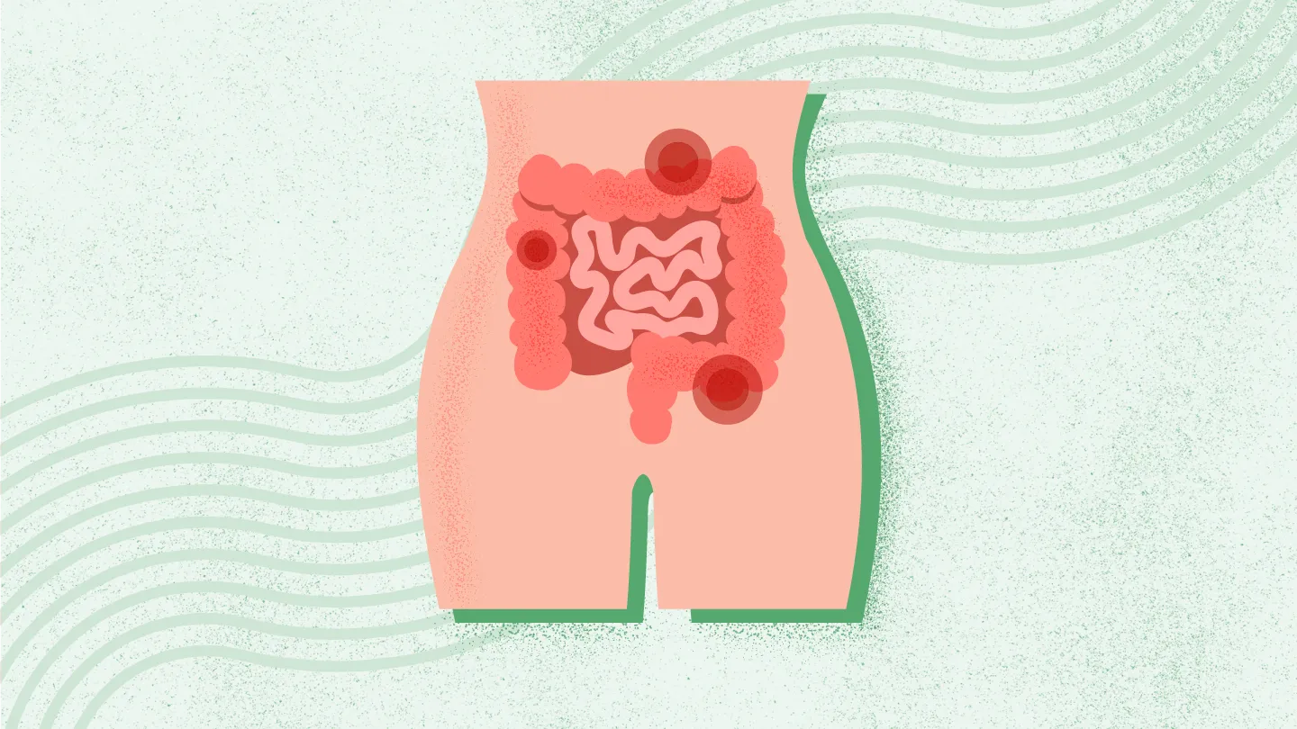 What Is Constipation? Symptoms, Causes, Diagnosis, Treatment, and Prevention