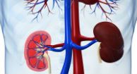 Gene Variants Predict Which Lupus Patients Will Have Kidney Trouble