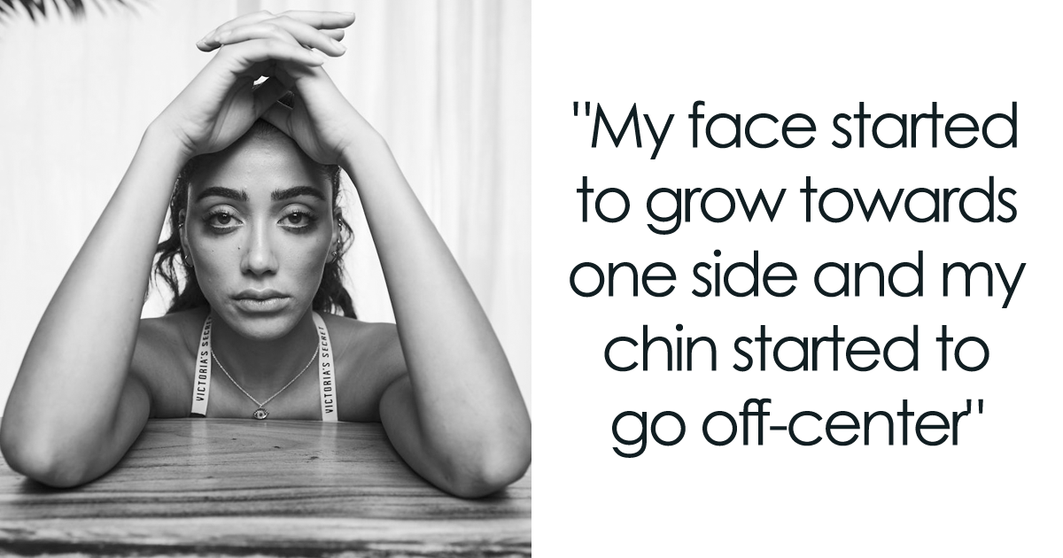 I Show Raw Pictures And Unedited Stories Of People And Their Body Insecurities (19 Pics)