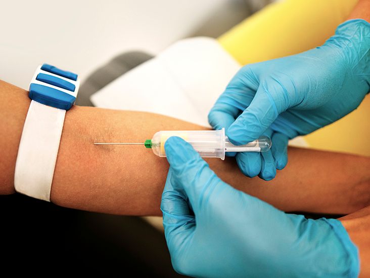 Immunoelectrophoresis-Serum Test: What You Need to Know