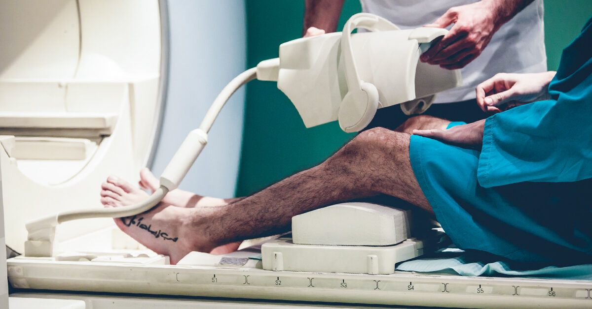 Bone Cancer in Knee: Symptoms, Diagnosis, and Treatment