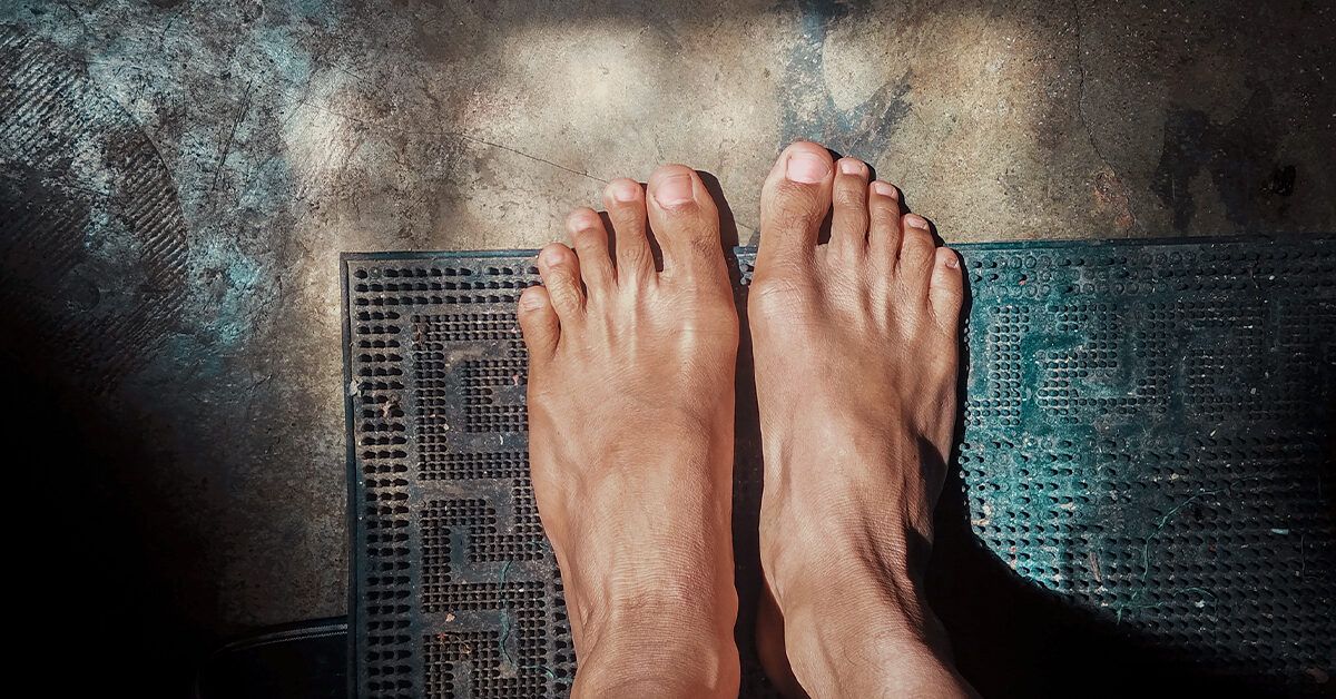 Bone Cancer: Can a Lump on Your Foot Be a Symptom?