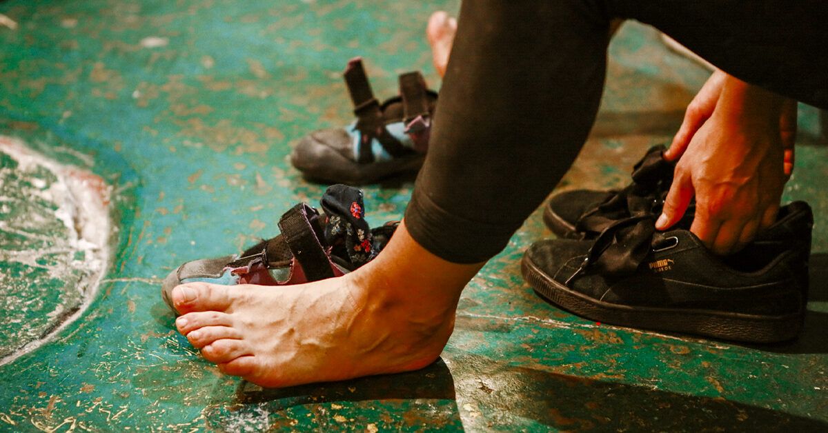 Fungal Skin Infections: Types, Treatment, Risk Factors, More