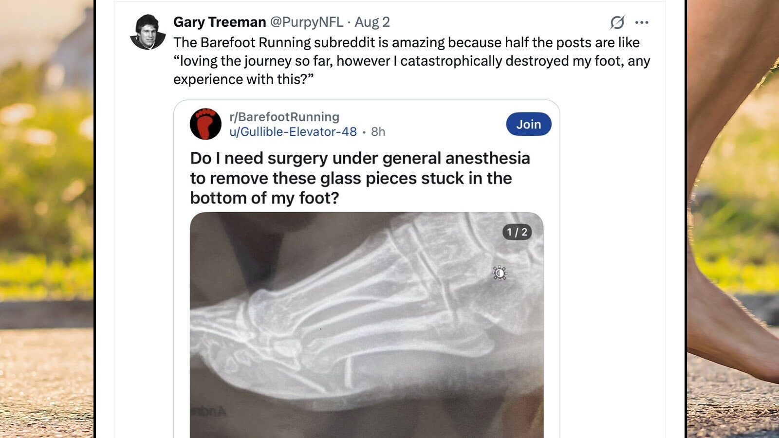 59 of the Funniest Burns from the Month of August 2025