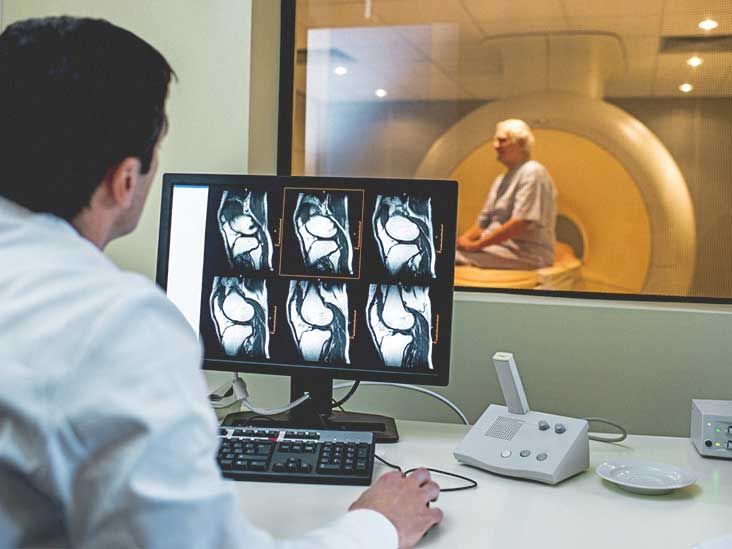 What Does Arthritis Look Like on an MRI?