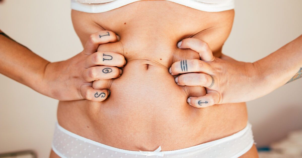 Mini Tummy Tuck: Cost, Procedure, and More