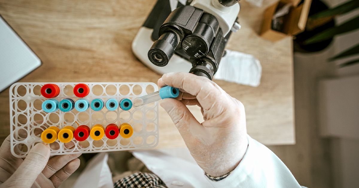 Toxoplasmosis Test: Procedure, Results, Treatment & More