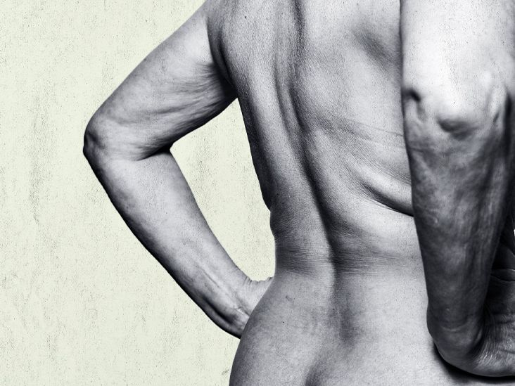 Tingling in the back: Causes, treatment, and prevention