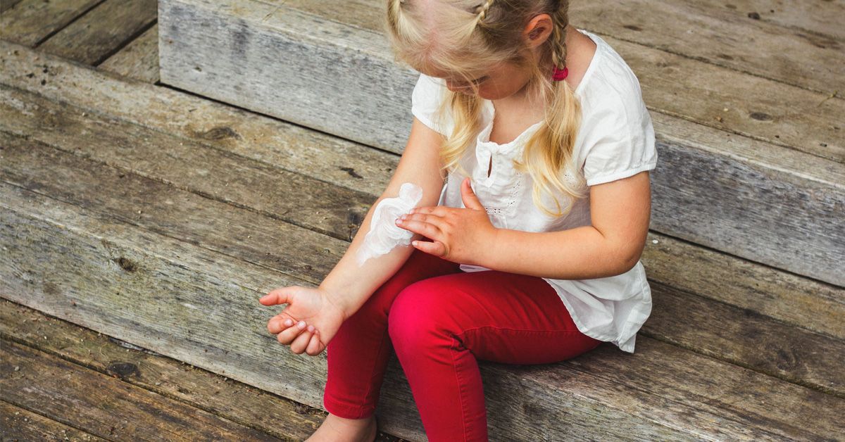 Eczema (Atopic Dermatitis): Symptoms, Causes, Treatment