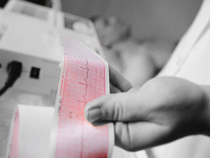 Congenital heart disease: Heart defects, types, and causes