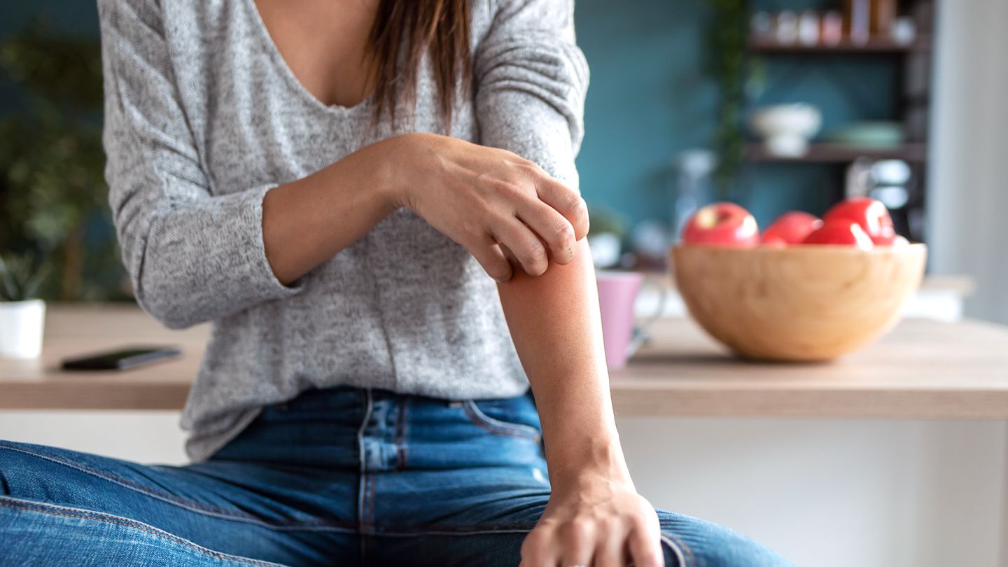 Signs You May Need to Change Your Psoriasis Treatment