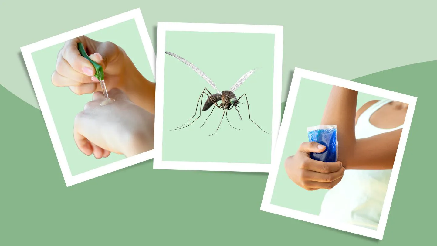 How to Get Rid of Mosquito Bites and Stop the Itch